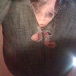 elszakadt a nadrágom... - 5. kép