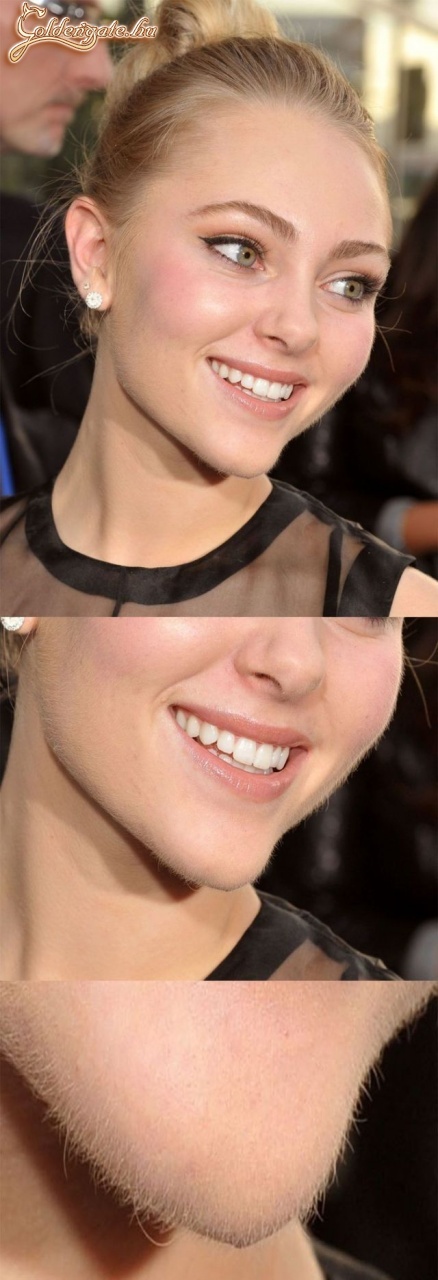 Jól látom az egy szakál?