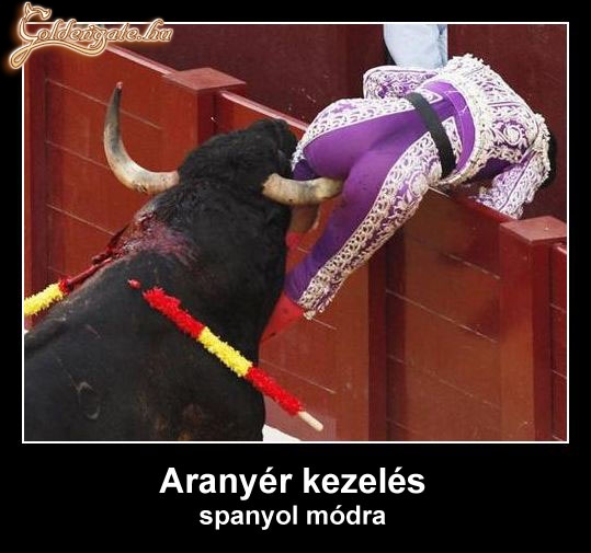 Aranyér kezelés