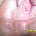 GoldenGate-archív 1472. sorozata - 3. kép