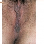 cic 2. sorozata - 1. kép