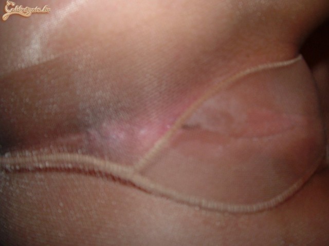 harisnyazolika 2. sorozata - 31. kép