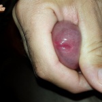 Fazonigazítás után. - 1. kép