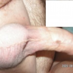 Att3la 1. sorozata - 4. kép