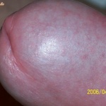 absolute.v 1. sorozata - 6. kép