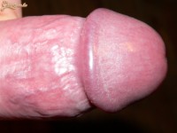 pinalucsok 2. sorozata