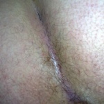 GoldenGate-arch - 10. kép