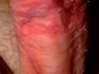 HyperSperm 1. sorozata