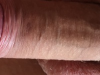 KKŰ 