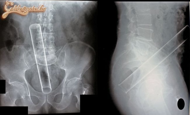 Kicsit becsusszant :D