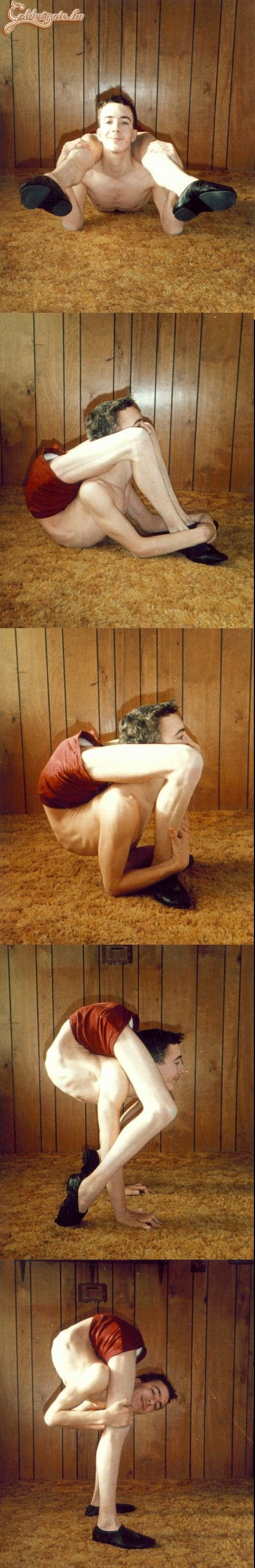 Férfiaknál azért ez relatív ritka...