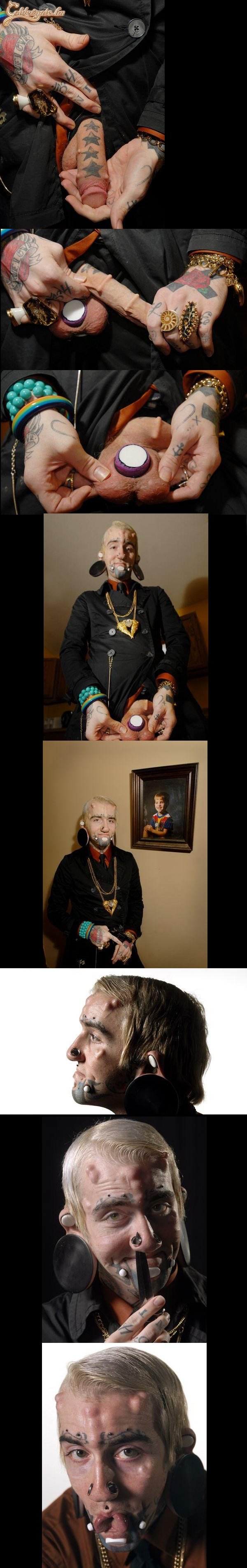 Igen, Ő egy súlyos eset