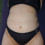 Szolid.... - 12. kép