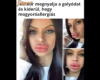 Mogyoróallergia