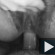 Anal