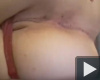 Anál