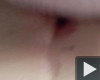 Egy kis anál