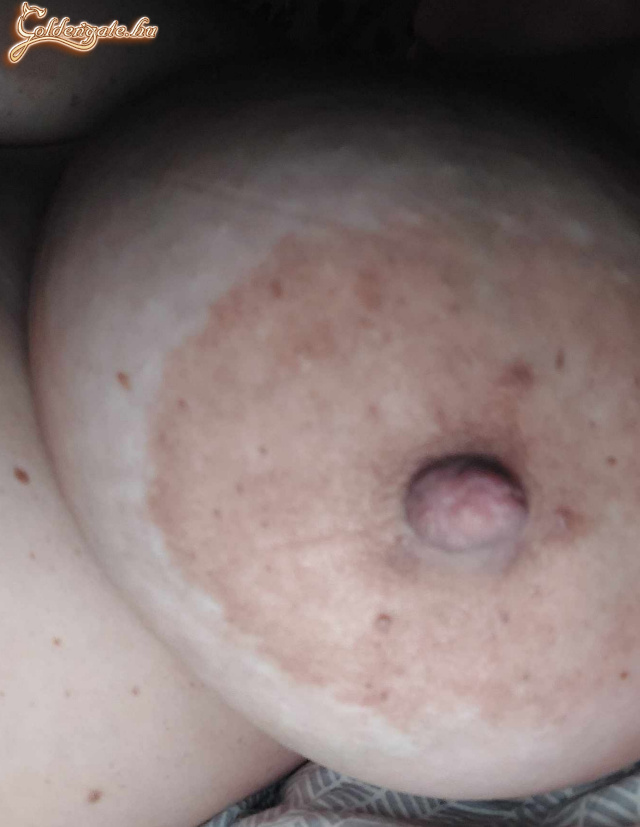 Mellek, fedetlenül... - 18. kép