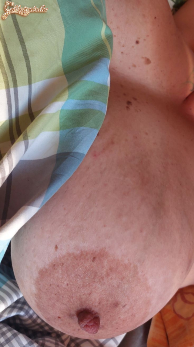 Mellek, fedetlenül... - 32. kép