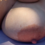 Mellek, fedetlenül... - 10. kép