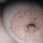 Mellek, fedetlenül... - 18. kép