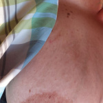 Mellek, fedetlenül... - 32. kép