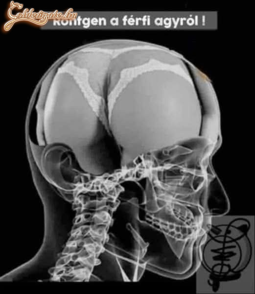 Agy