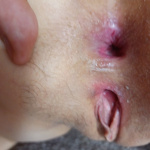 Egy kis popó  - 9. kép