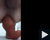 anál plug