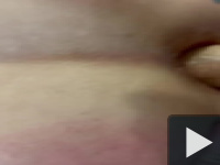 E.......Anal