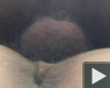 A nudin 1