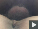A nudin 1