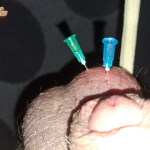 Farok tortura - 8. kép