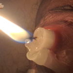 Farok tortura - 10. kép