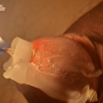 Farok tortura - 11. kép