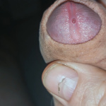 Kis kukacka!  - 3. kép