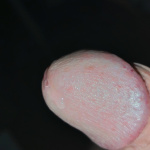 Kis kukacka!  - 4. kép