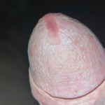 Kis kukacka!  - 5. kép