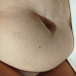 Dugható a negyedik lyuk is! - 4. kép