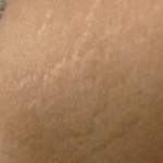 Dugható a negyedik lyuk is! - 18. kép