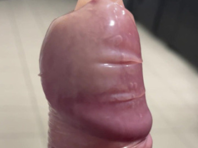 Rizikós farokverés