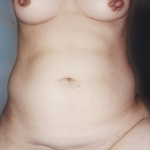 Sziszike vegyes  - 14. kép