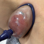 Felpumpálva - 12. kép