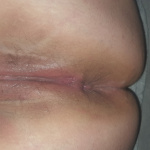 Partneremmel. - 18. kép