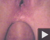 Anal... Anal...