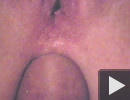 Anal...