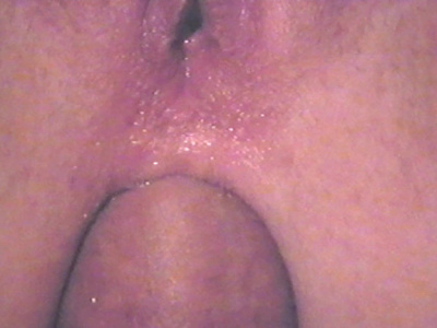Anal...