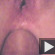 Anal...
