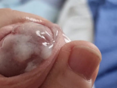 Már megint ki kellet verni