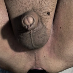 Anal Plug - 9. kép